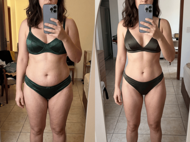 Resultado Bruna, 33 anos