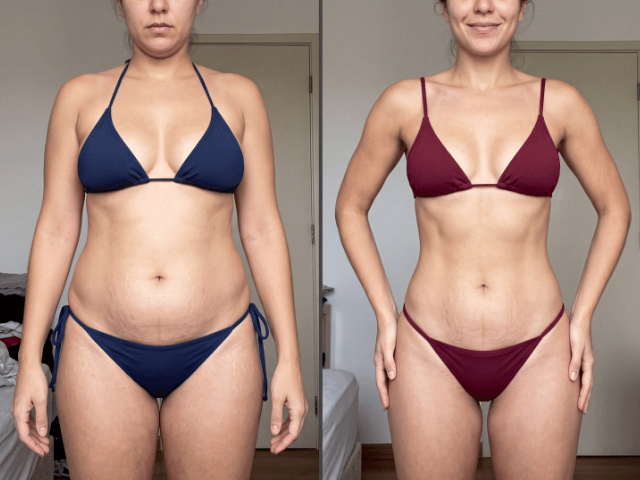 Resultado Mariana, 27 anos